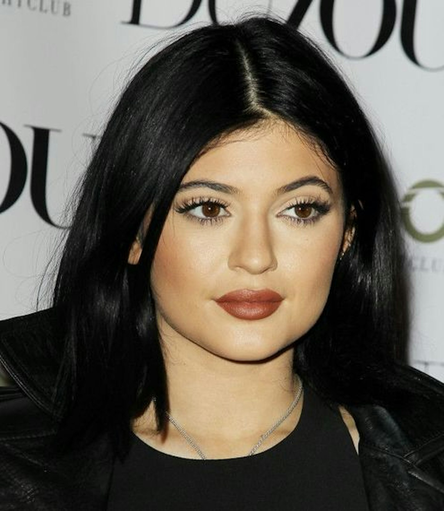 Kylie Jenner plastic surgery timeline - lip fillers, nose job, hair