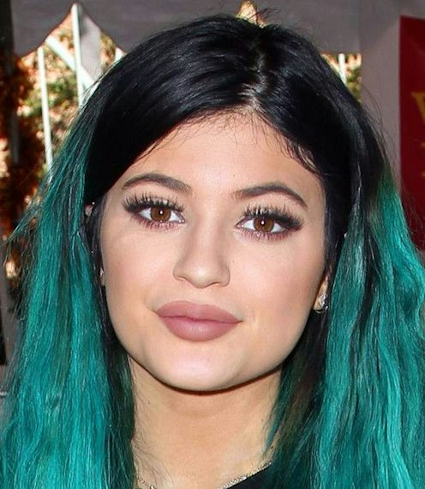 Kylie Jenner plastic surgery timeline - lip fillers, nose job, hair