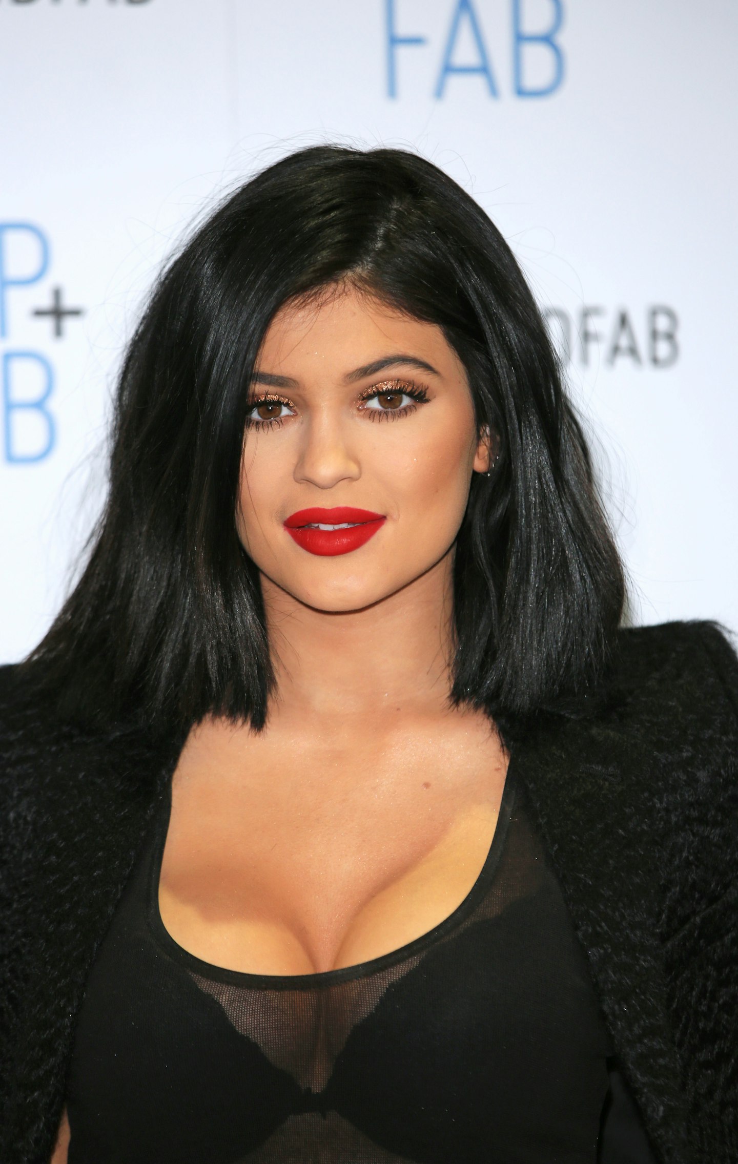 Kylie Jenner plastic surgery timeline - lip fillers, nose job, hair