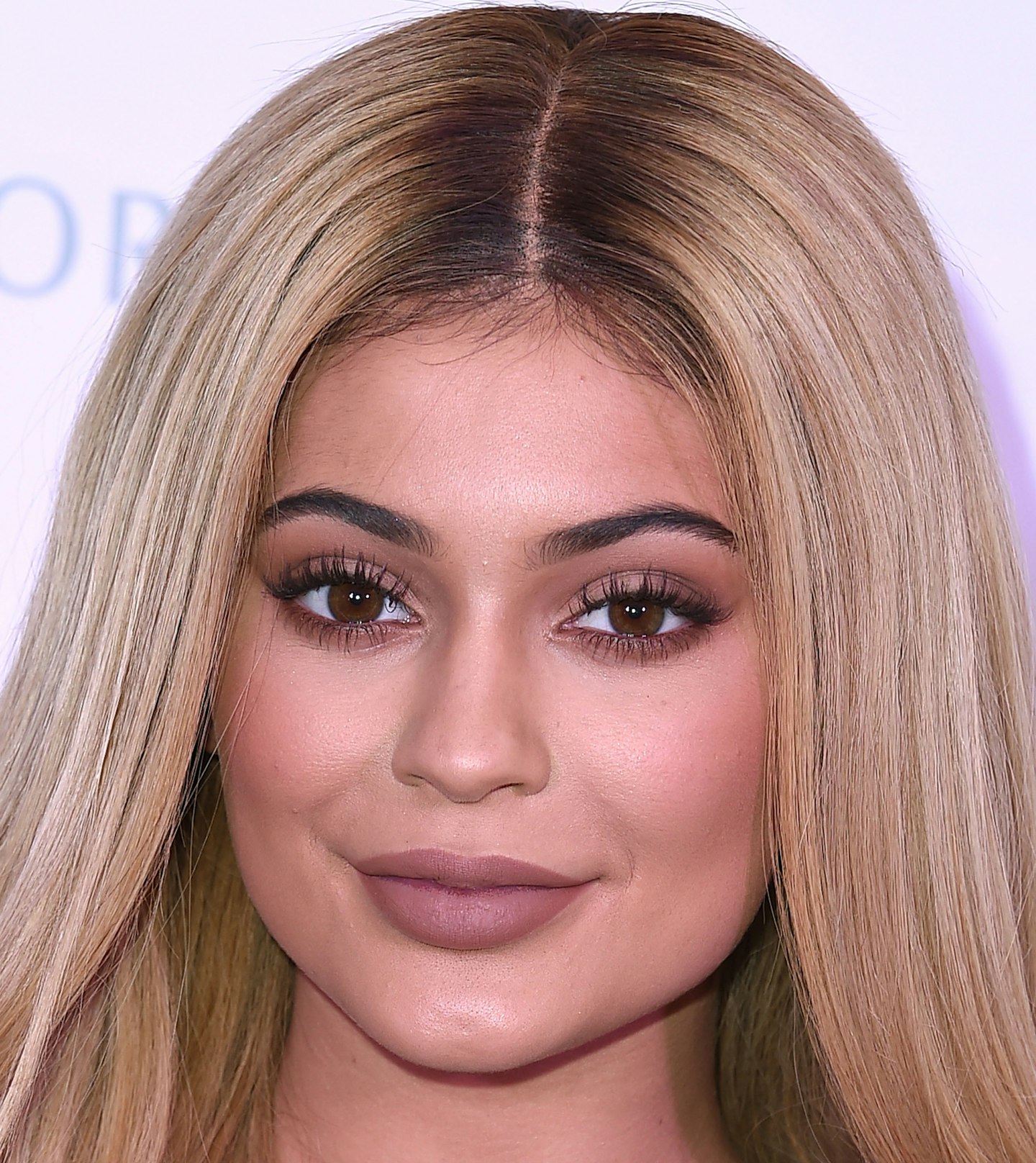 Kylie Jenner plastic surgery timeline - lip fillers, nose job, hair