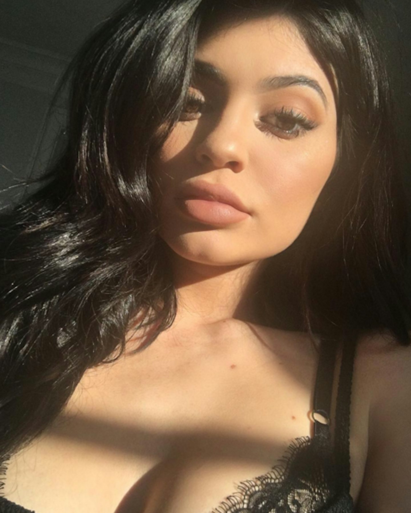 Kylie Jenner plastic surgery