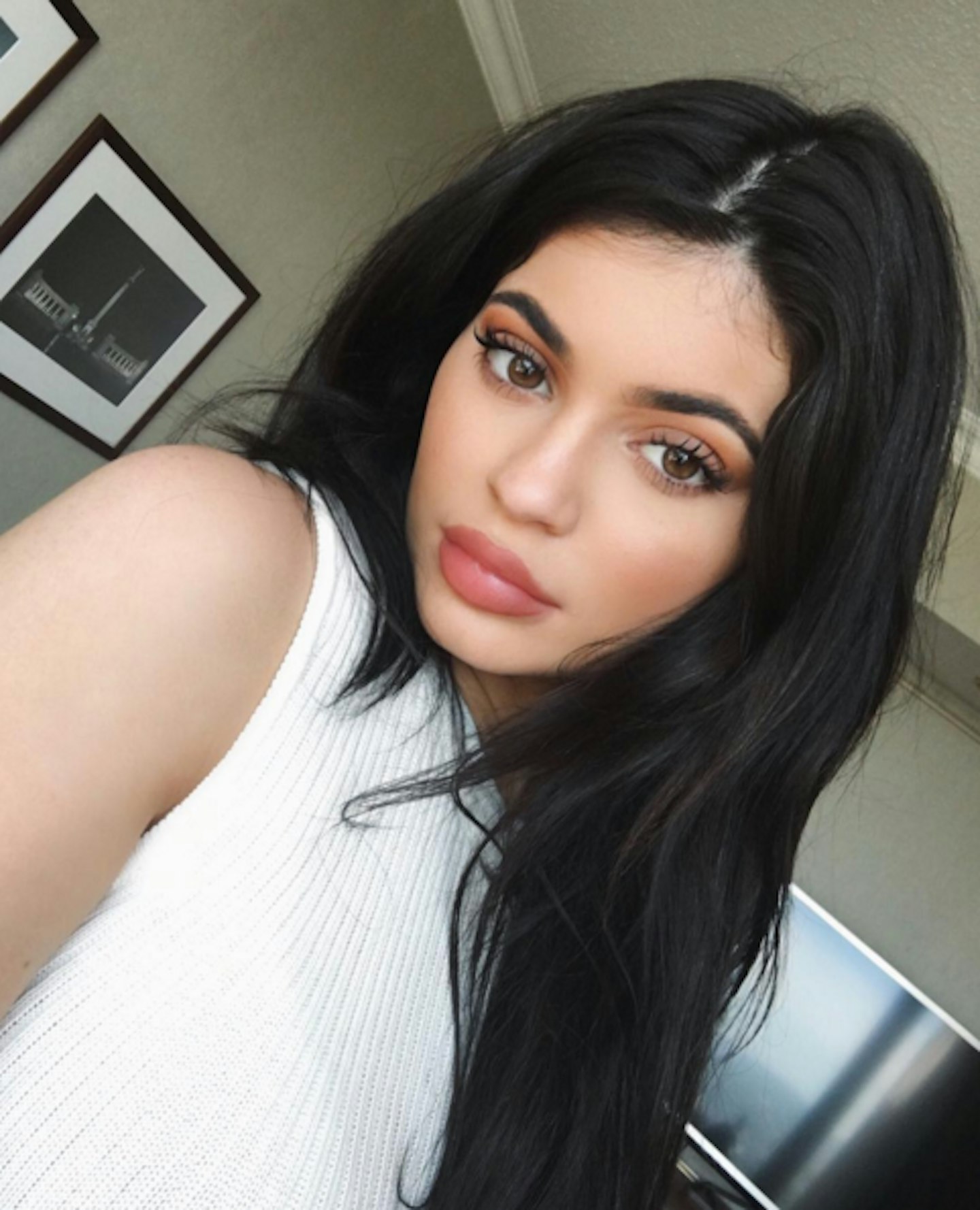 Kylie Jenner plastic surgery