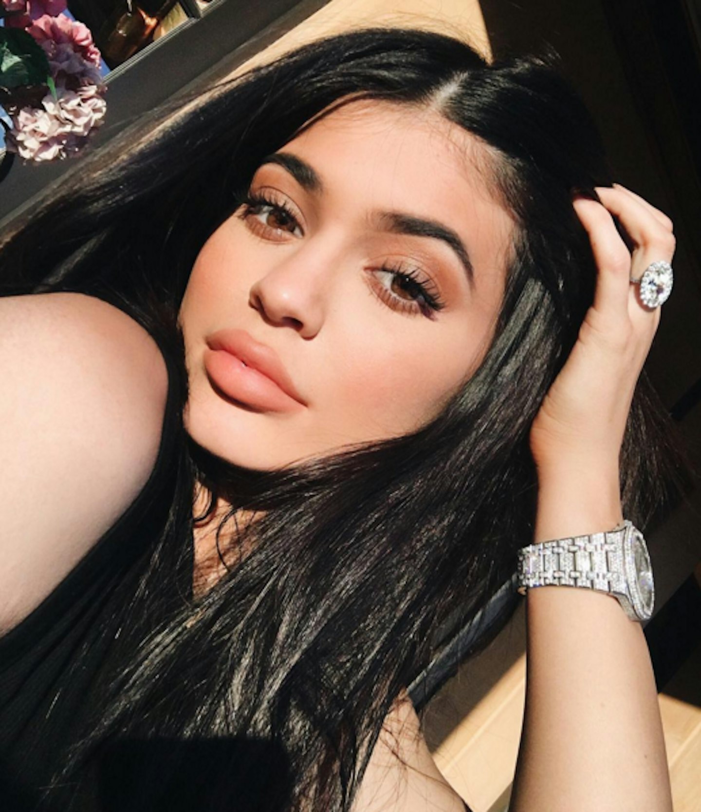 Kylie Jenner plastic surgery