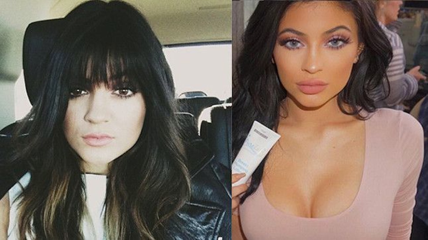 Kylie Jenner Transformation