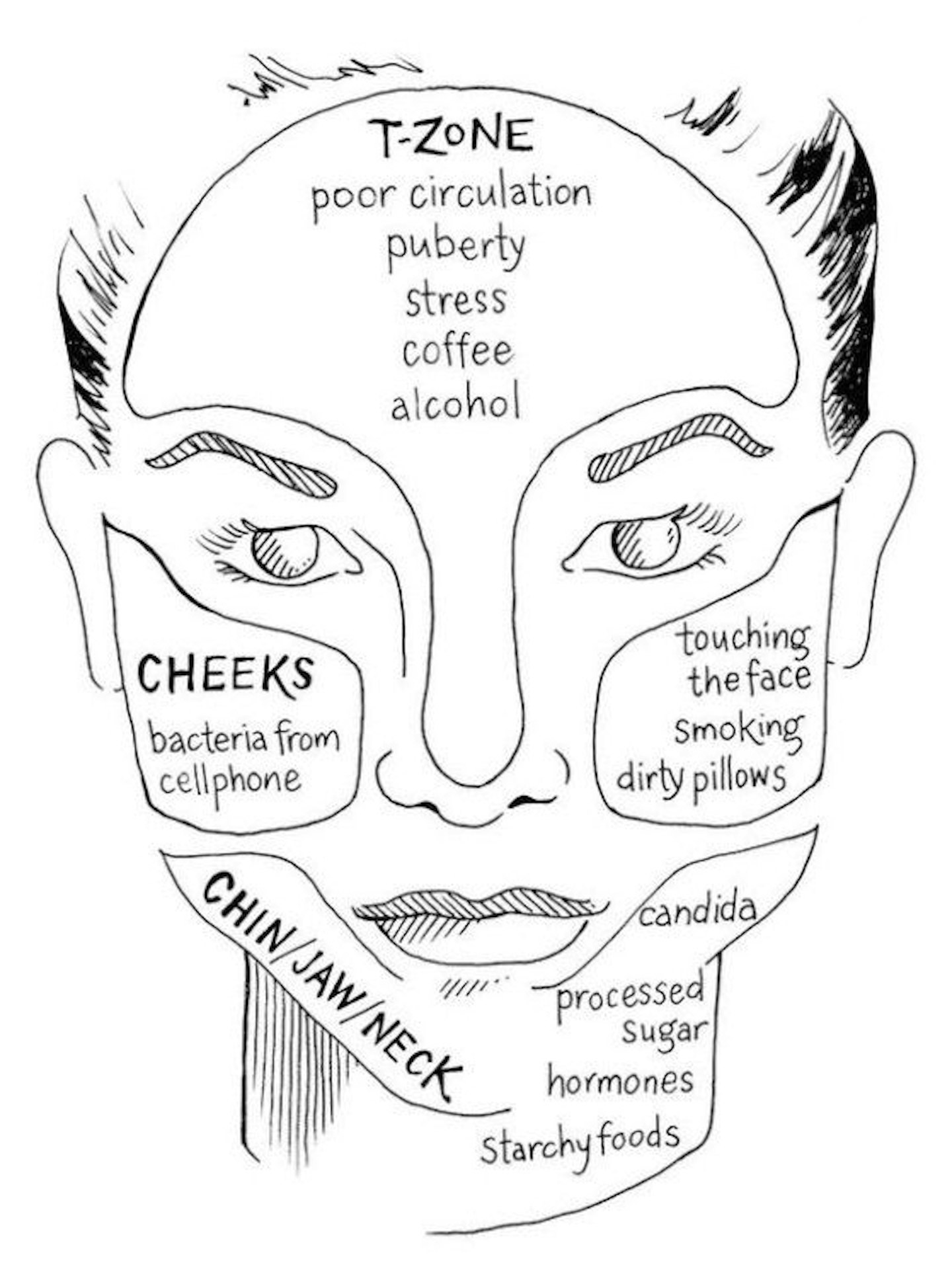 face mapping acne