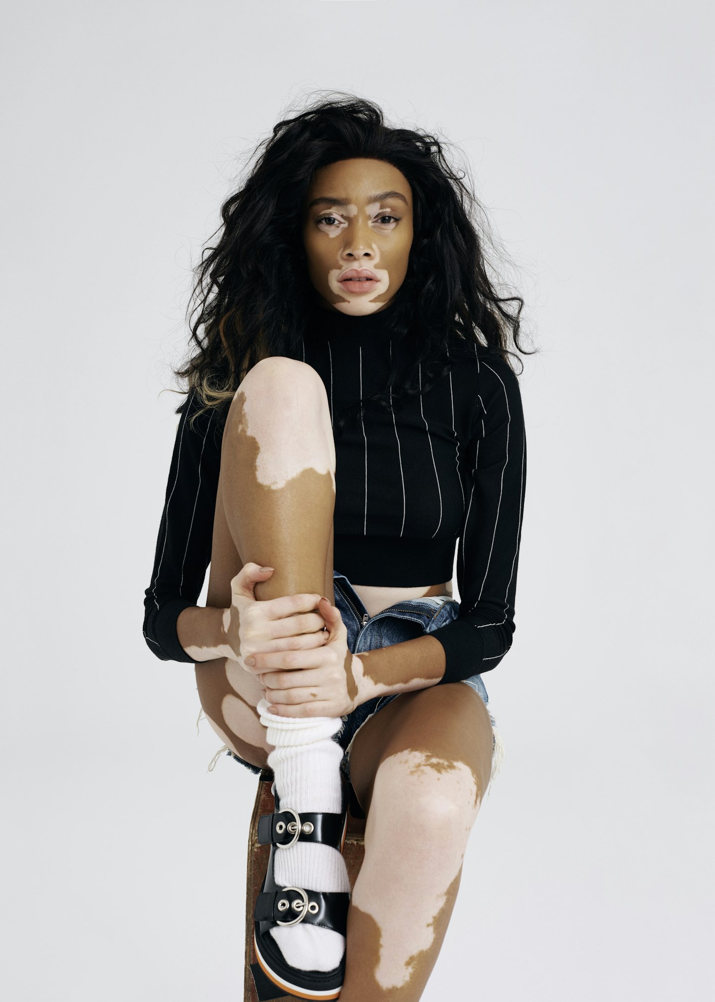 winnie harlow