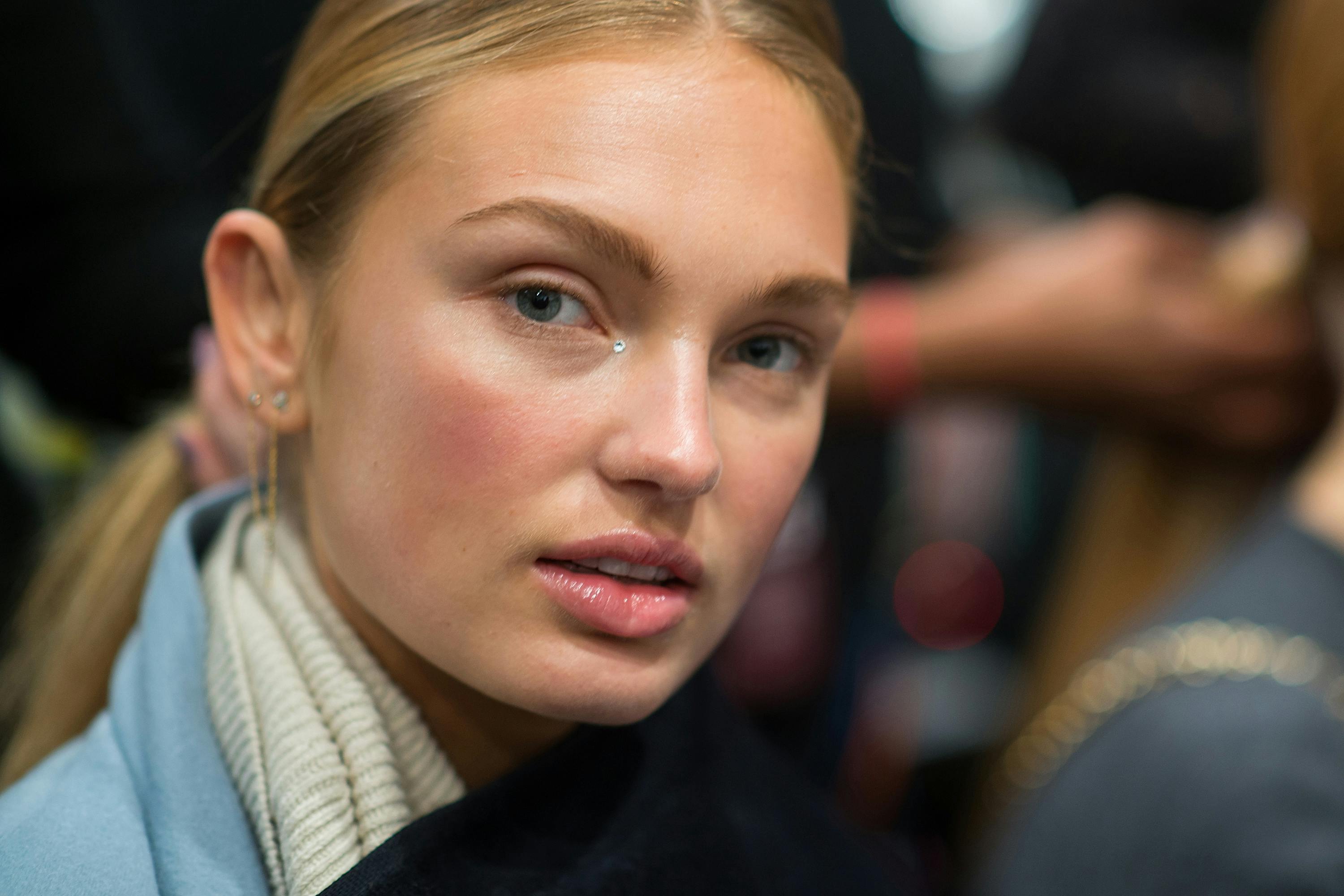 Under Eye Bags & Dark Circles: Causes, Treatments & Remedies - Grazia