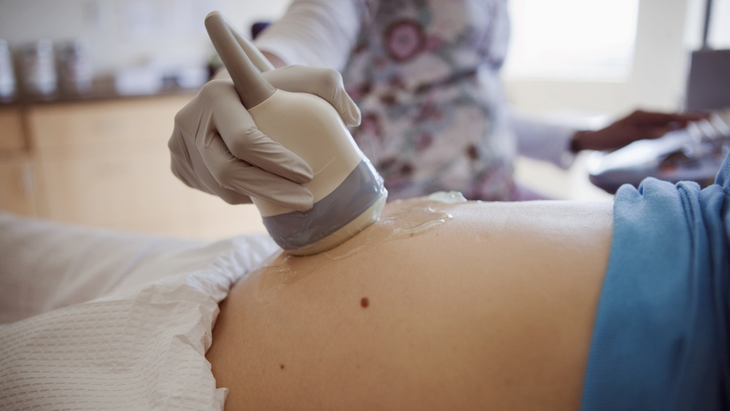 ultrasound images are identical leaving mums livid