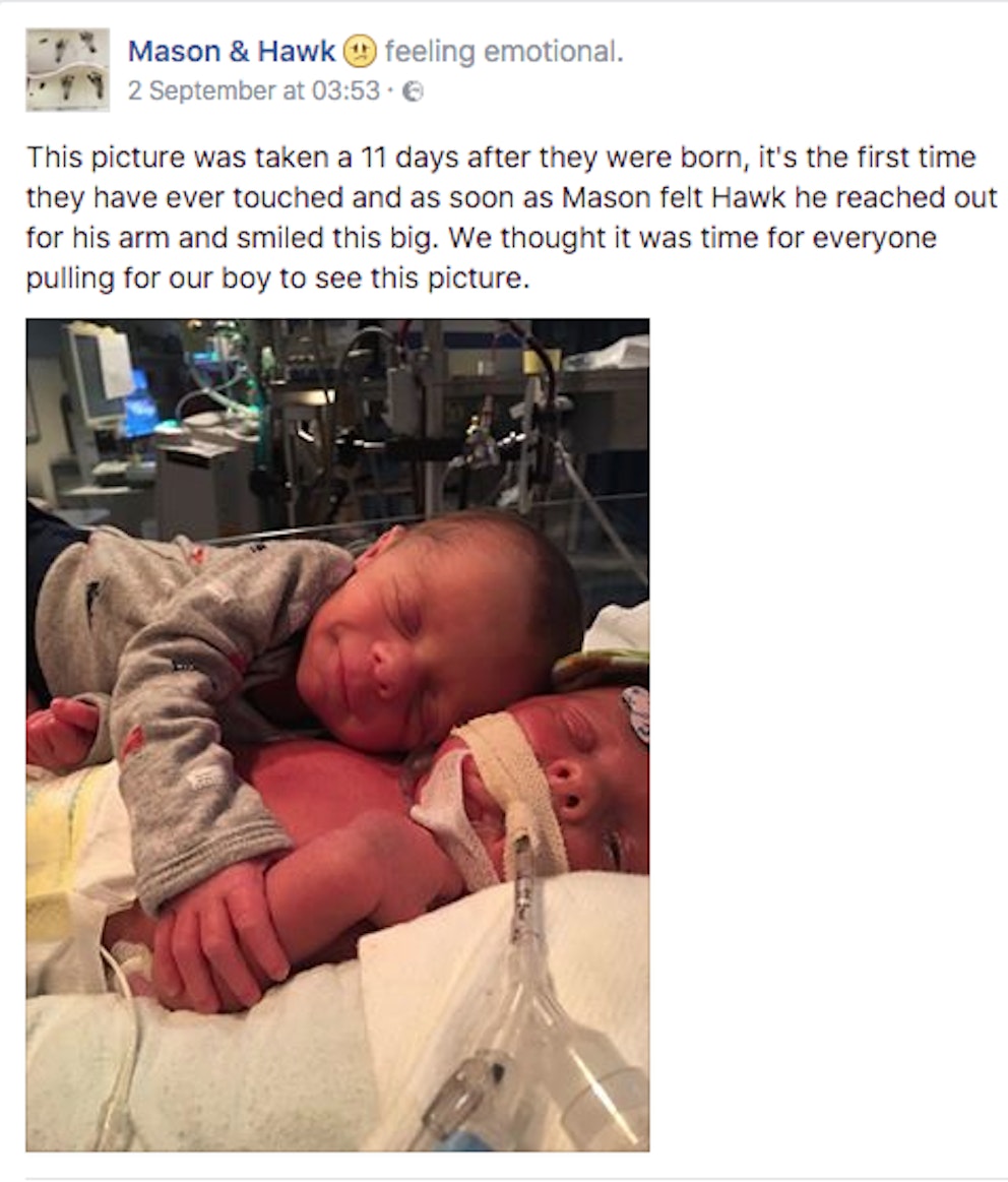 This heartbreaking picture of twin brothers has gone viral Closer