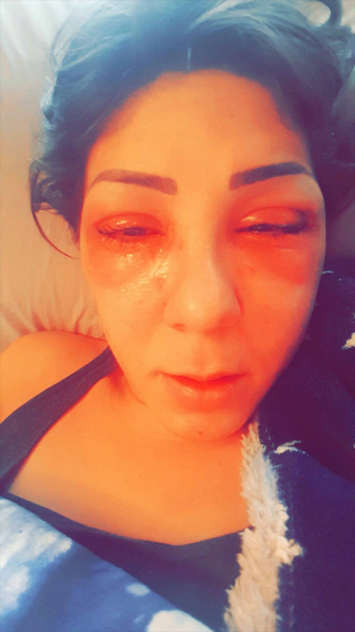 Layla Kilany LVL eyelash allergic reaction