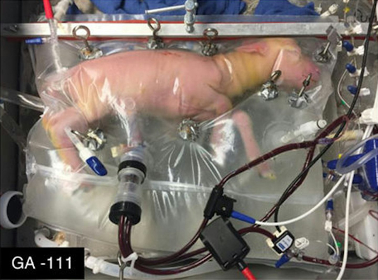 artificial-womb-premature-babies-grow-special-bags-lamb-experiment-chop-childrens-hospital-of-philadelphia