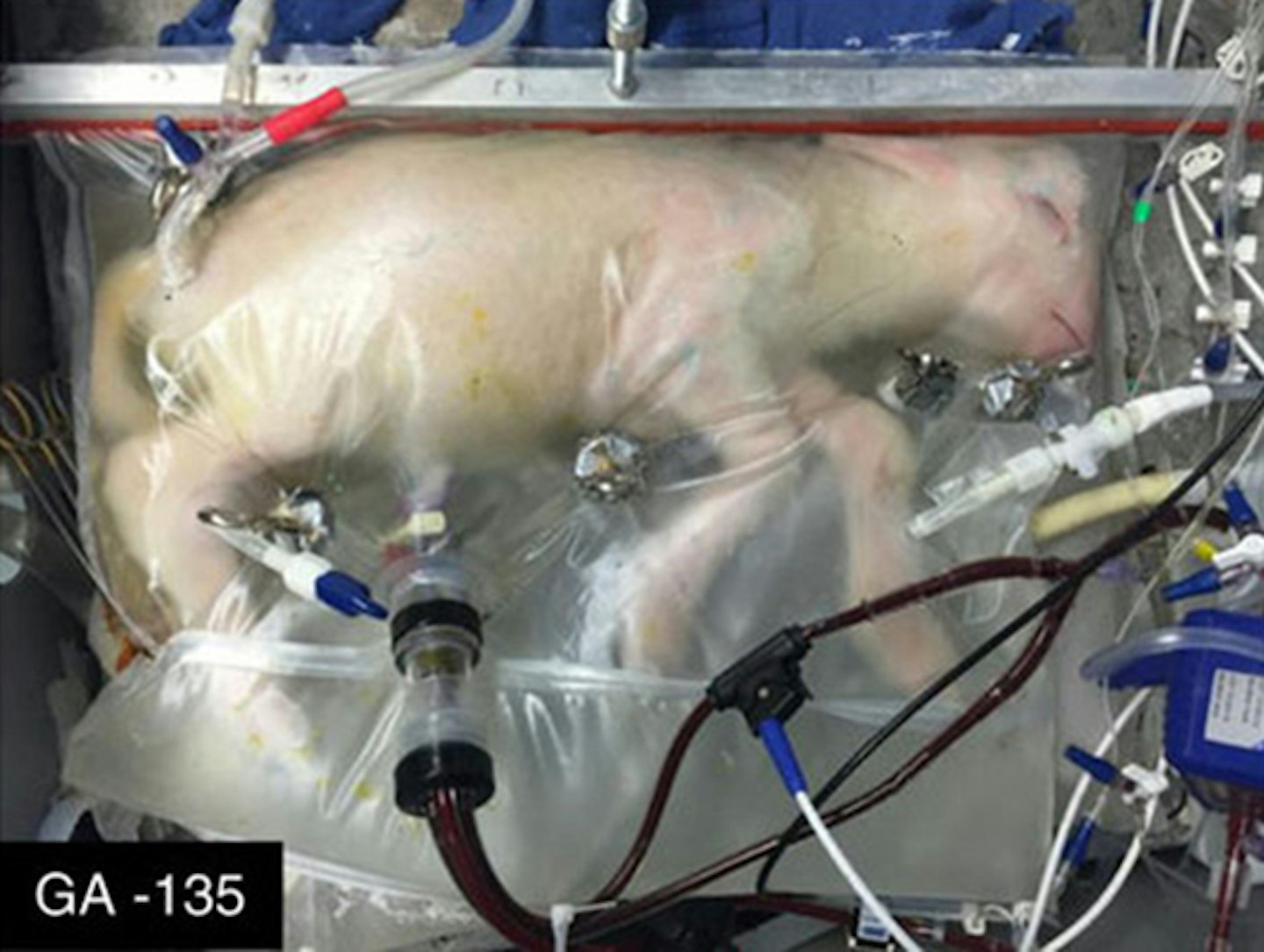 artificial-womb-premature-babies-grow-special-bags-lamb-experiment-chop-childrens-hospital-of-philadelphia