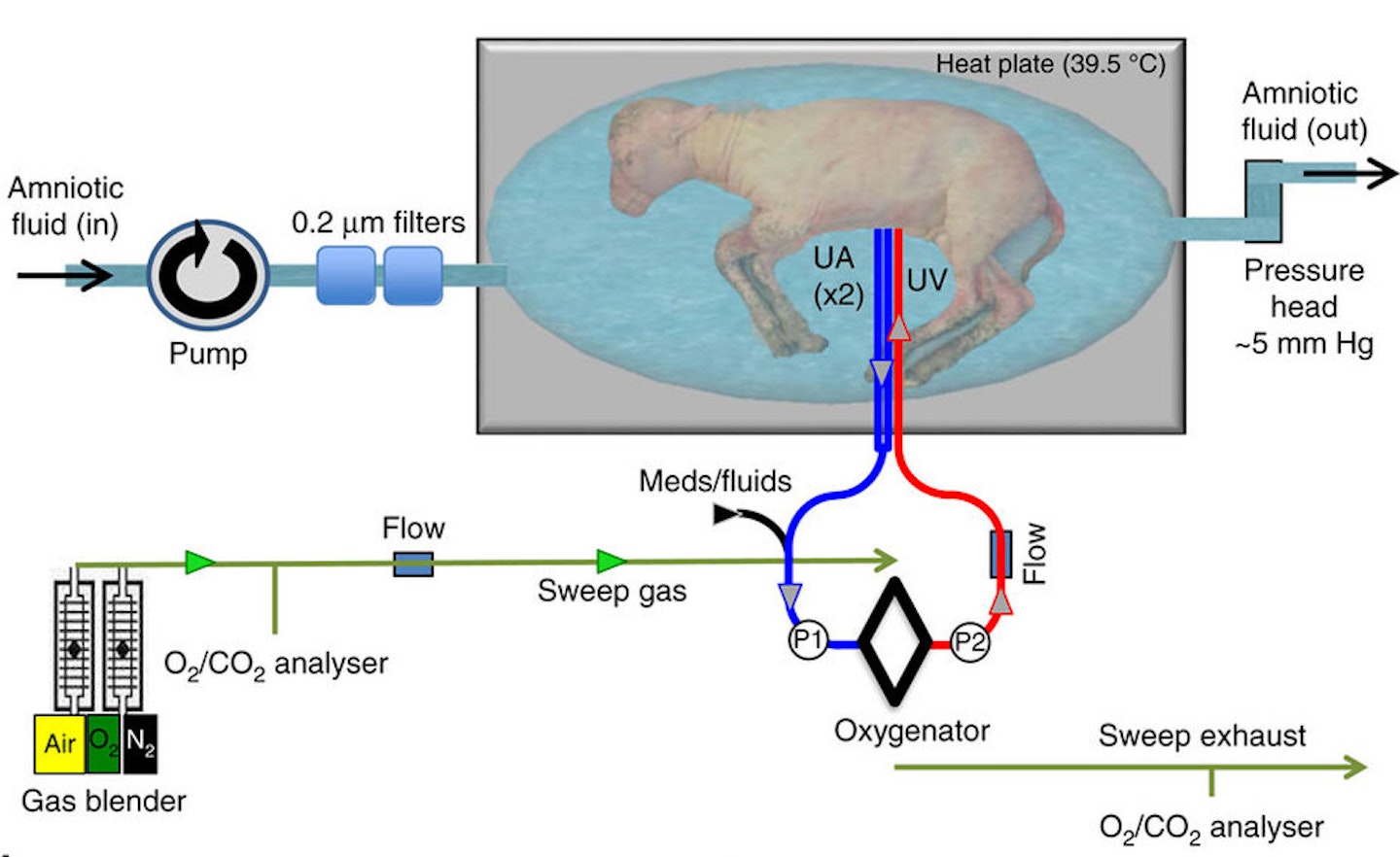 artificial-womb-premature-babies-grow-special-bags-lamb-experiment-chop-childrens-hospital-of-philadelphia