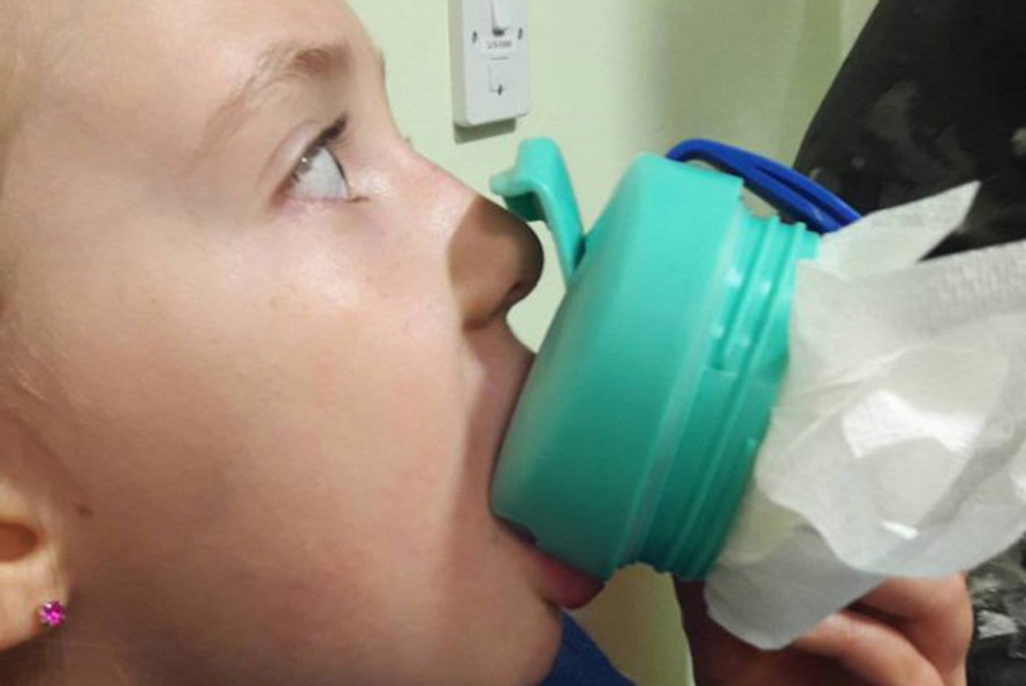 7-year-old-girl-megan-donald-natalie-rushed-hospital-tongue-trapped-disney-cup