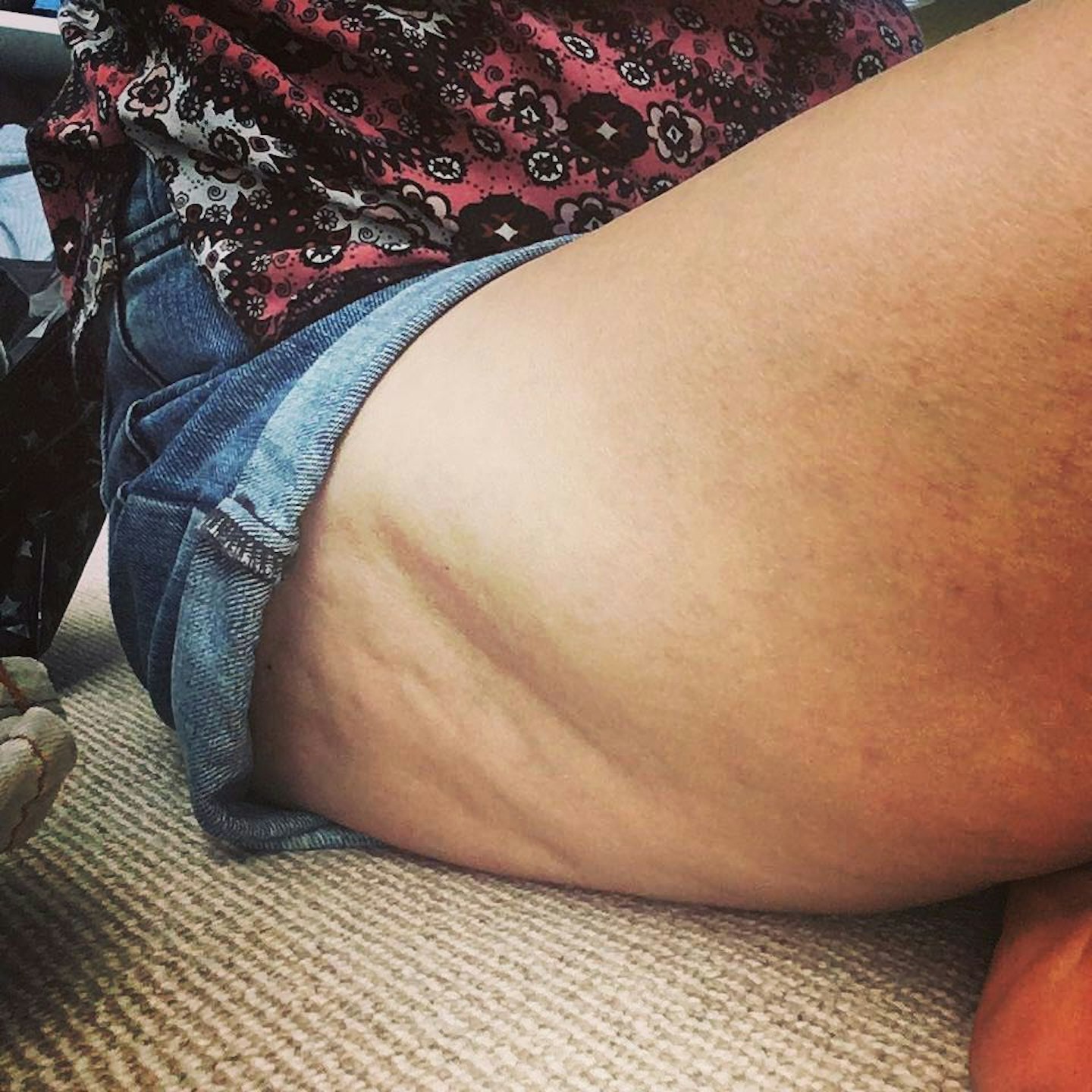 unmumsy-mum-posts-honest-pic-celulite-instagram-followers-praise-perfect-legs
