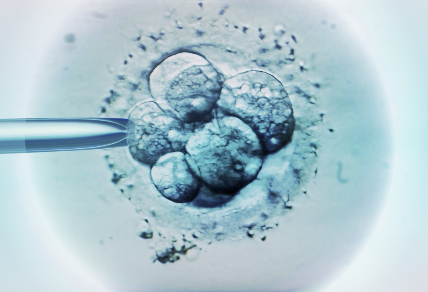 ivf gender selection 