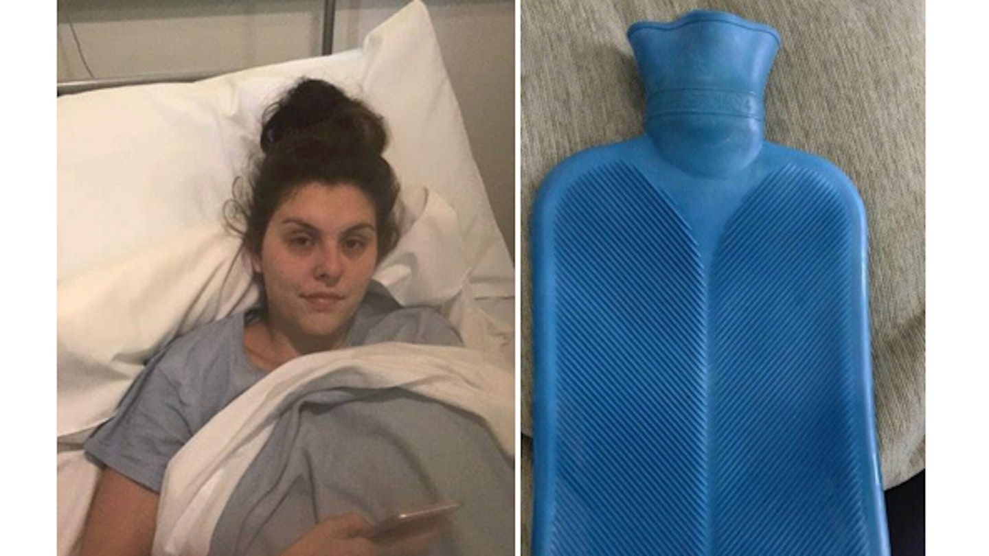 Hot water bottle exploded Shauna Bryne