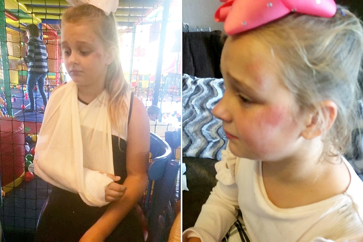 casie-morrison-10-girl-knife-wielding-killer-clown-broken-arm