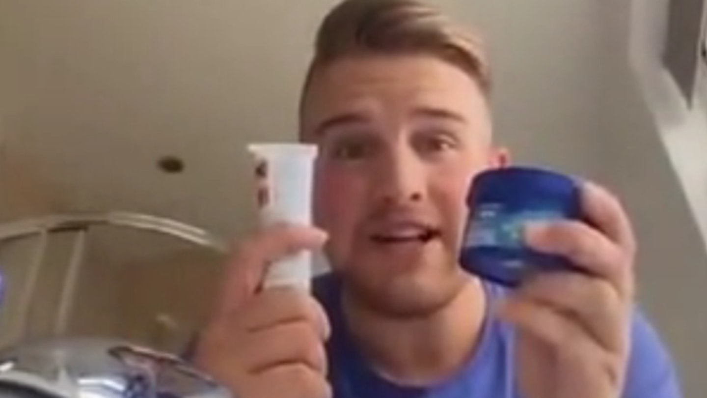 VIDEO: Man’s ill-advised super glue hair prank leads to A&E visit