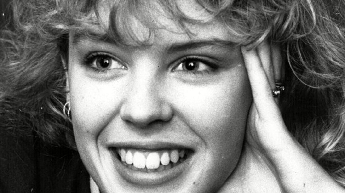 Kylie-Minogue-celebrity-teeth-before