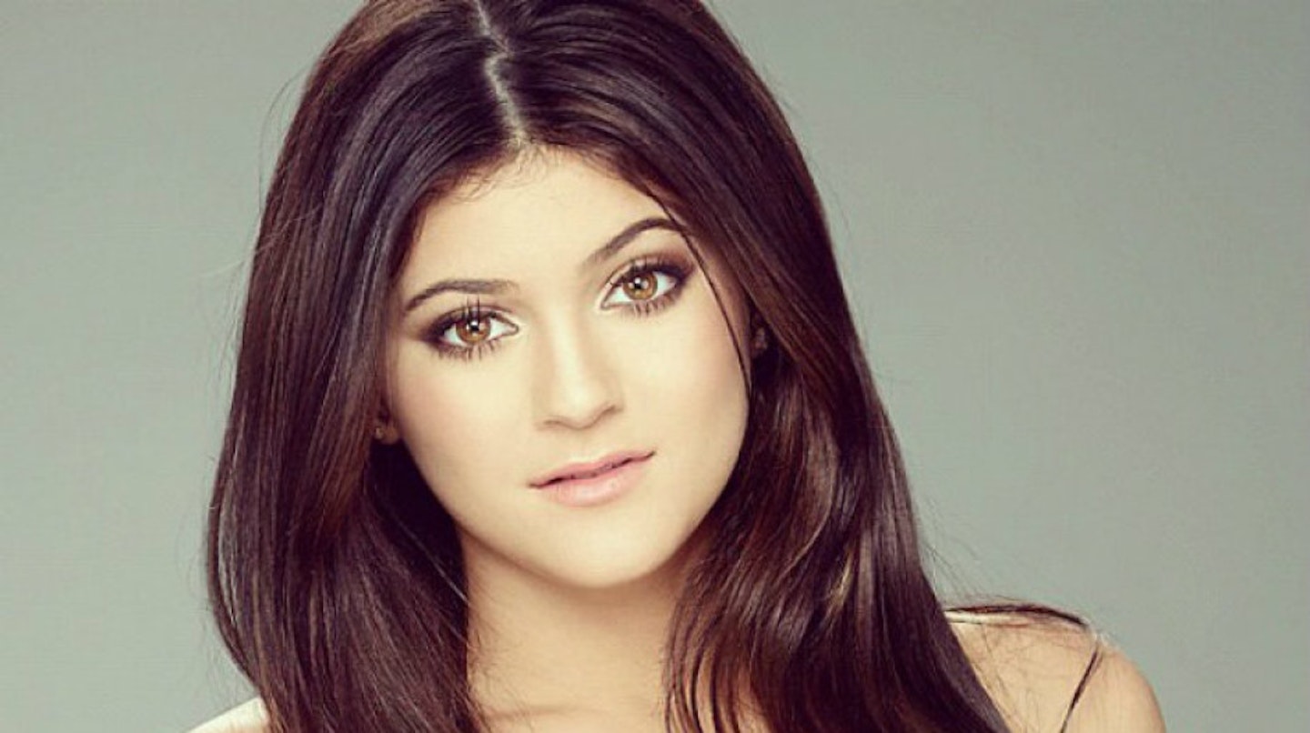 kylie-jenner-before-surgery6