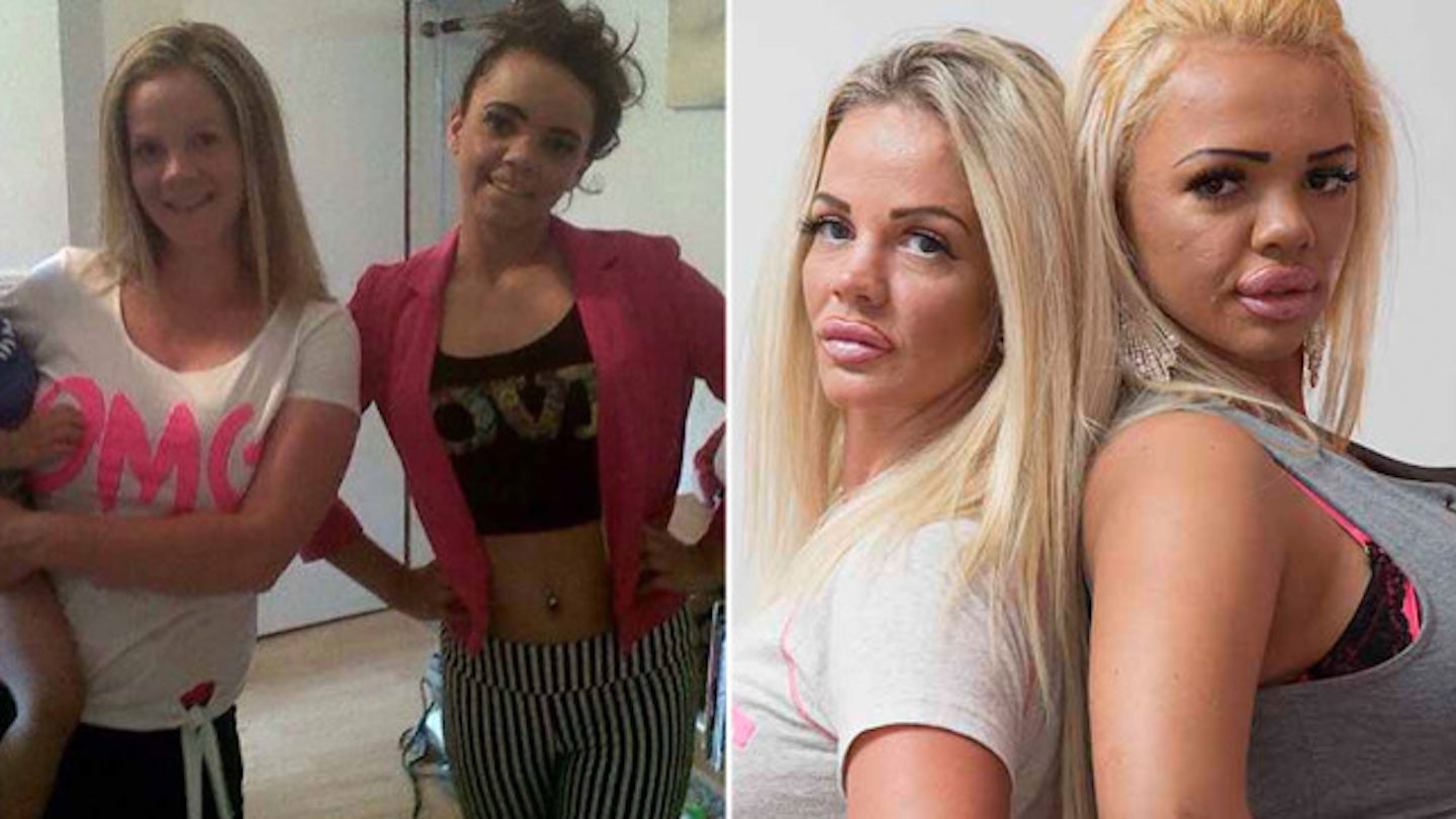Mum: ‘I let my daughter strip and have Sugar Daddies - so she can pay for our £56K plastic surgery addiction’
