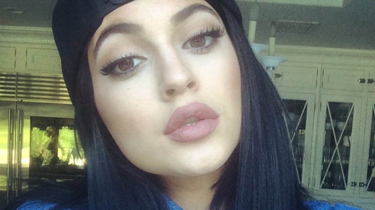 kylie-jenner-after-surgery2
