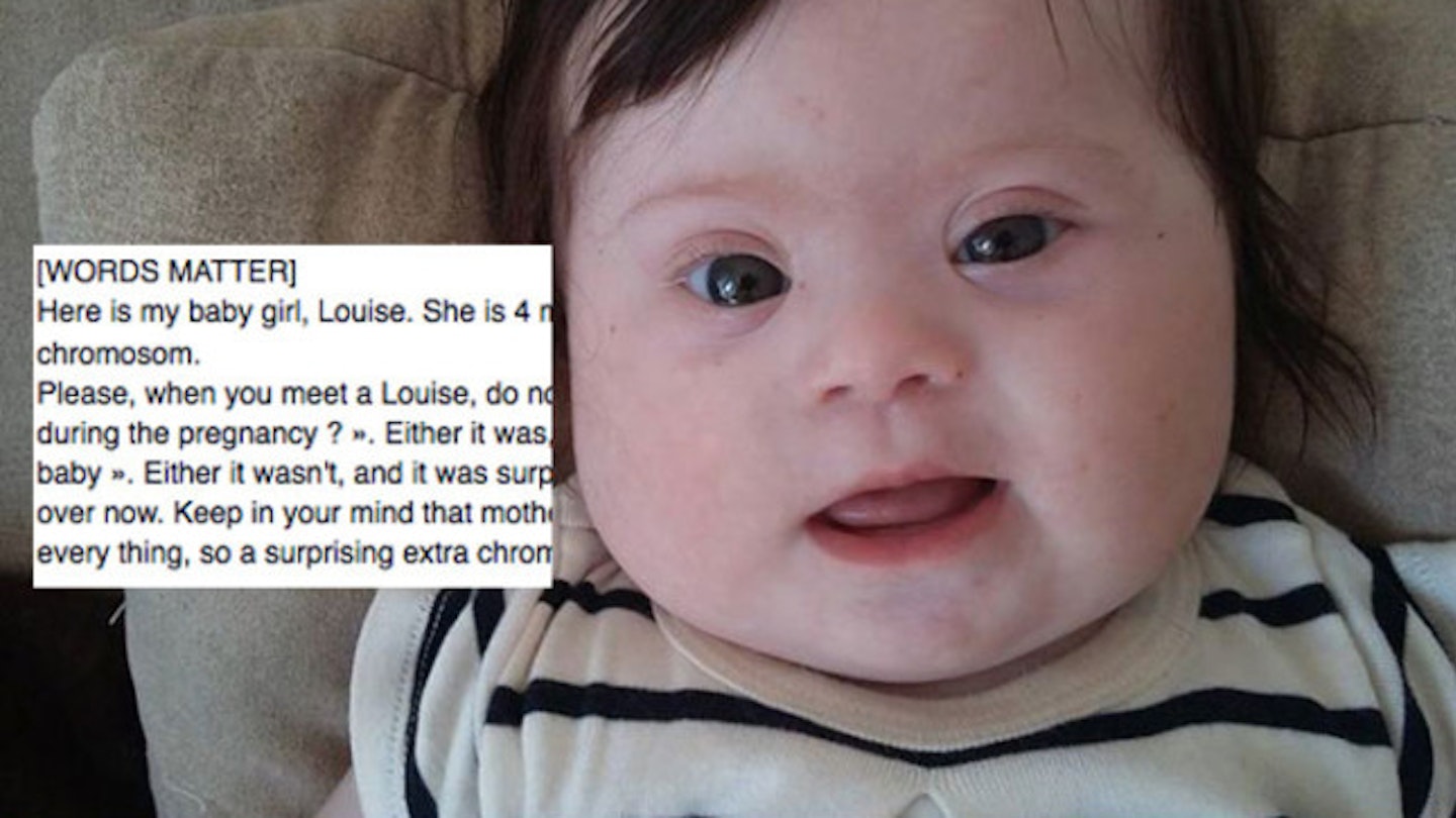 READ: Mother’s empowering post about baby daughter with Down’s Syndrome goes viral