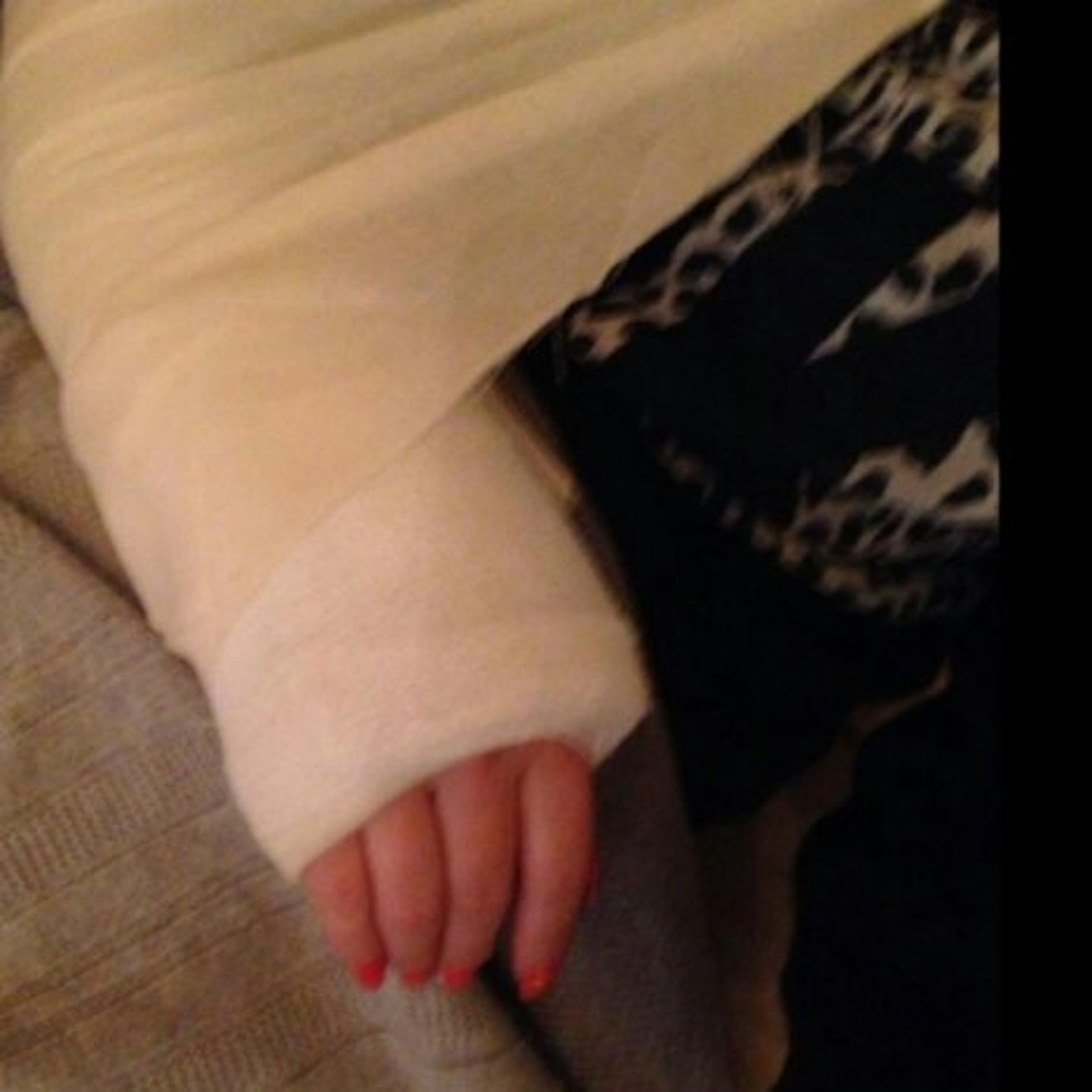 Kimberley tweeted this picture of her bandaged wrist, earlier this week