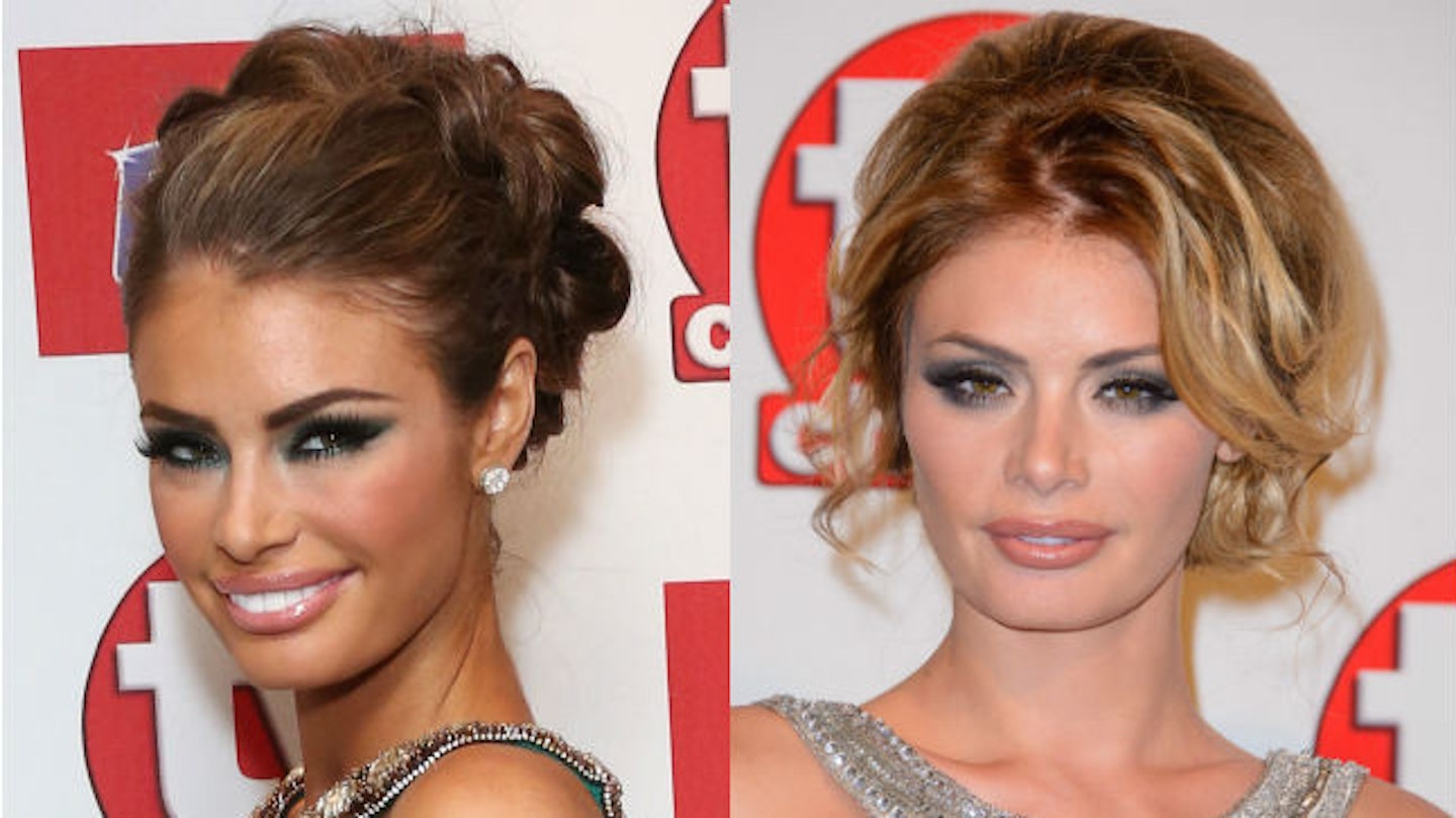 chloe sims before and after surgery