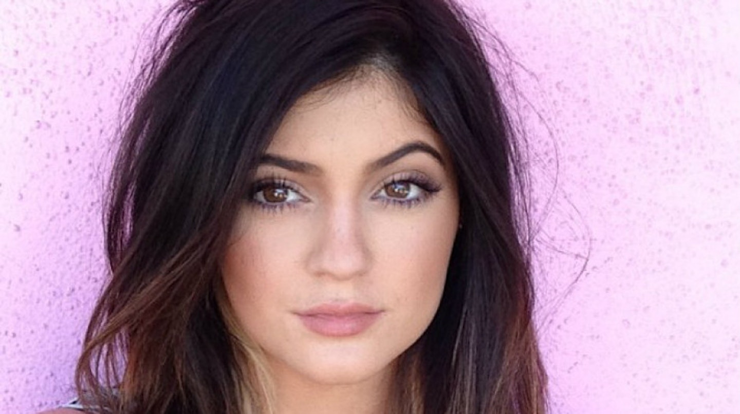 kylie-jenner-lips-before-surgery