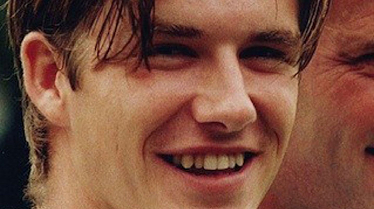 David-Beckham-teeth-before-veneers