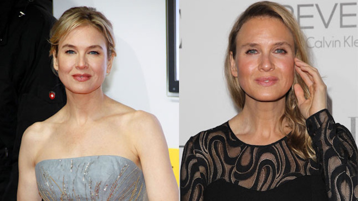 renee-zellweger