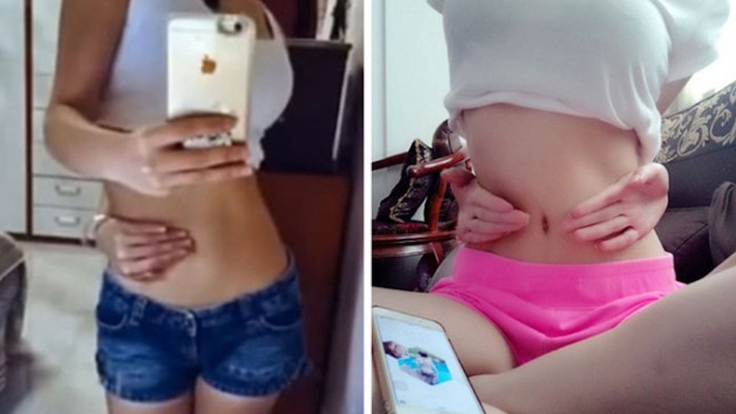 Can the Belly Button Challenge really tell you if you need to lose weight?