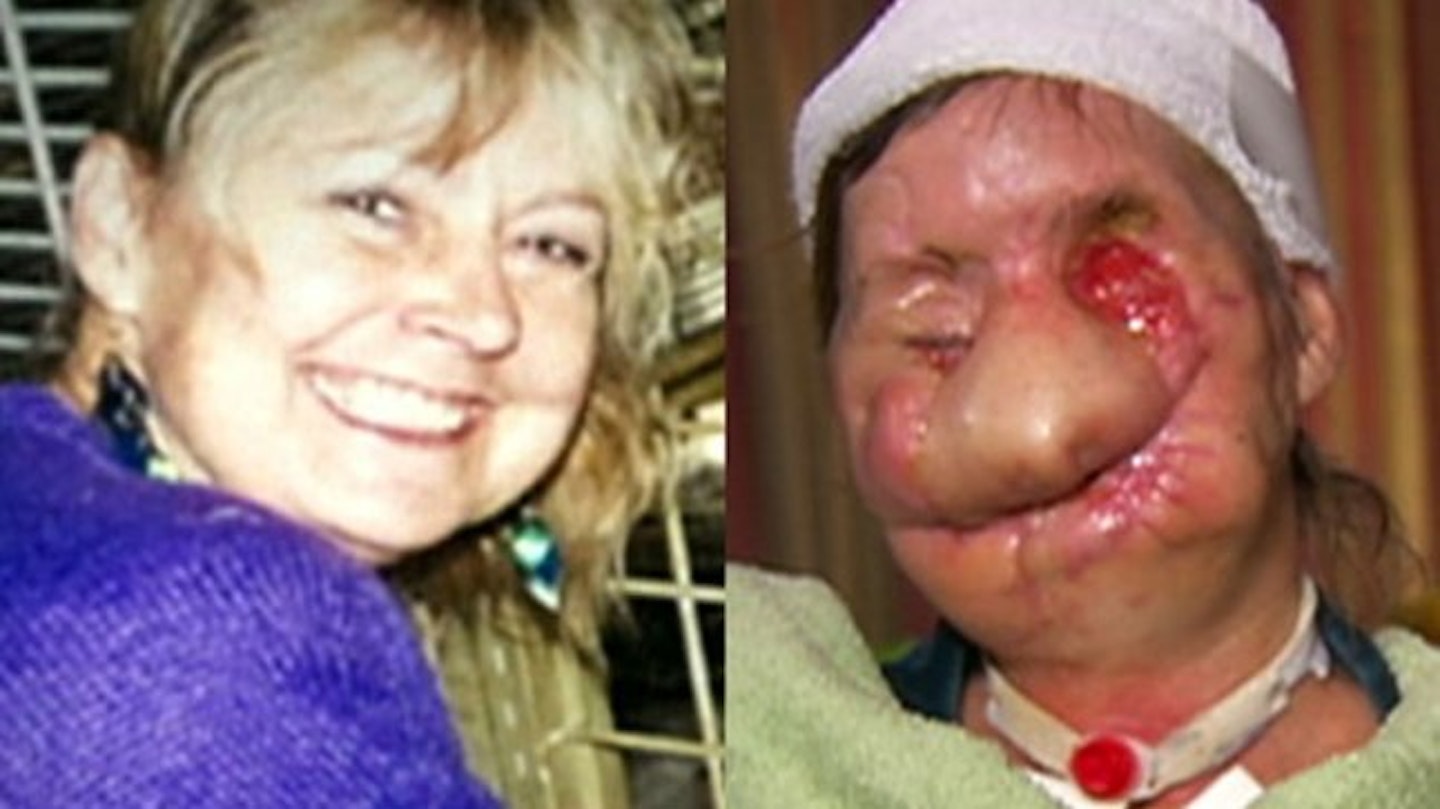 Charla Nash, immediately before and after the attack