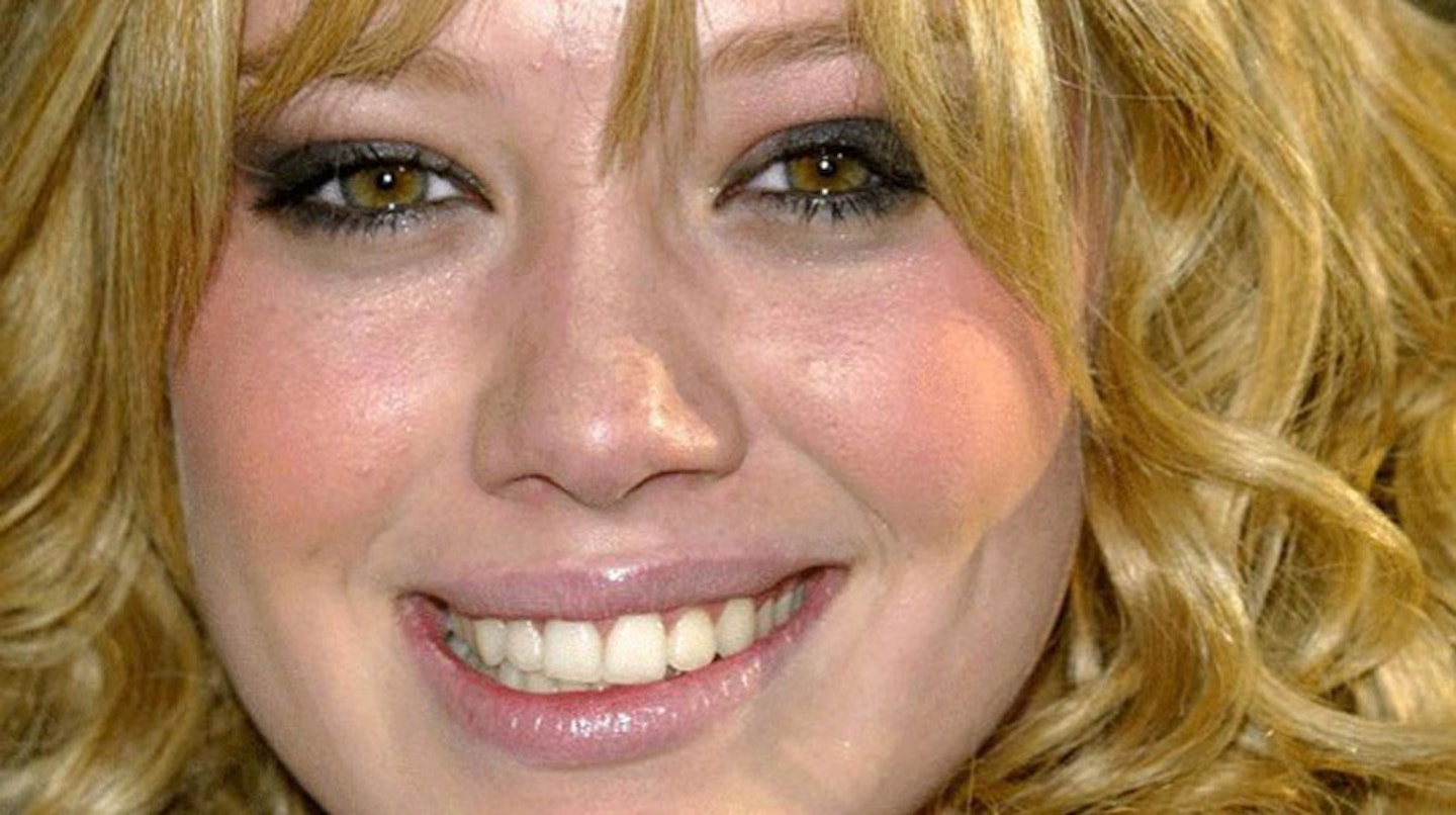Hilary-Duff-celebrity-teeth-before