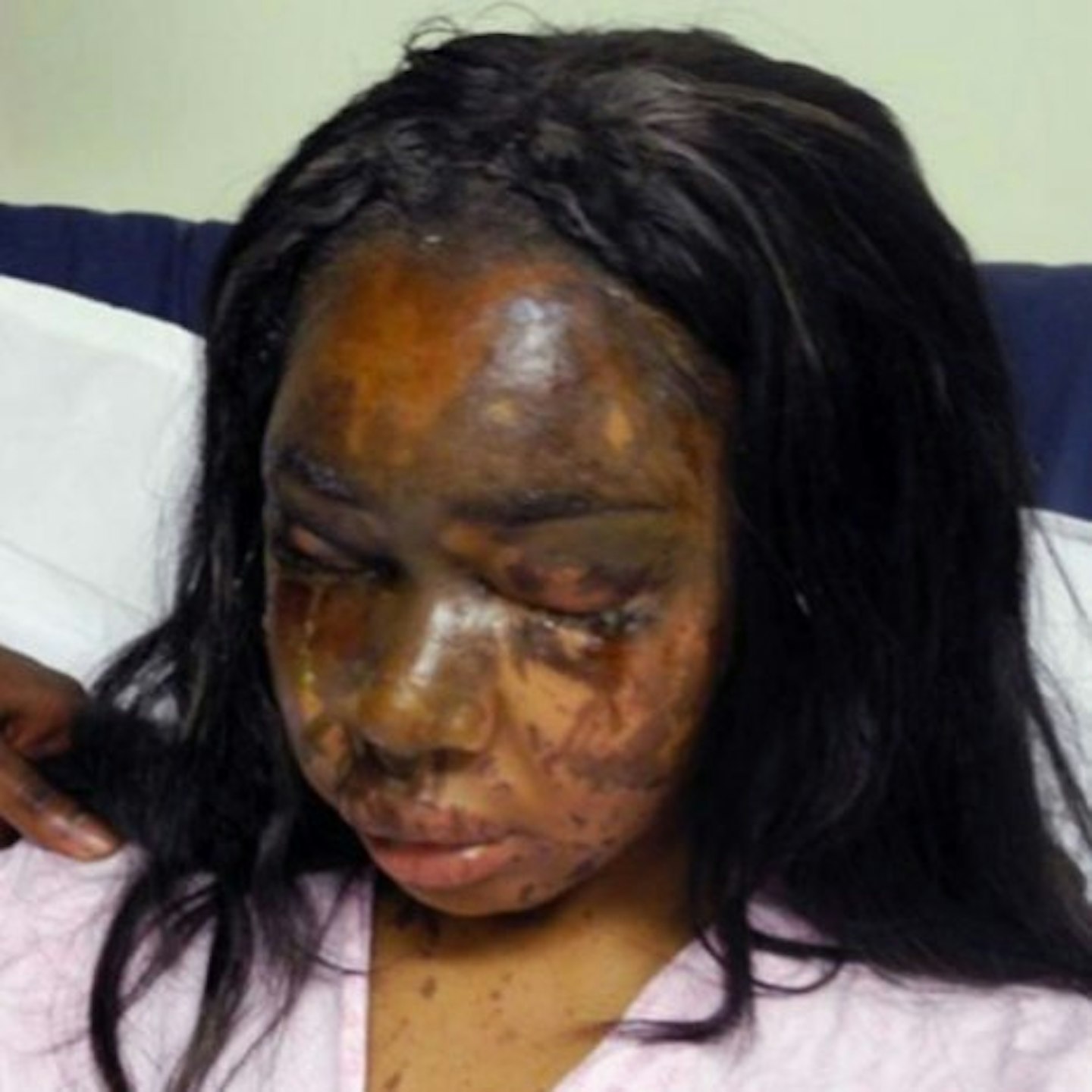 Naomi released photos of herself after the attack