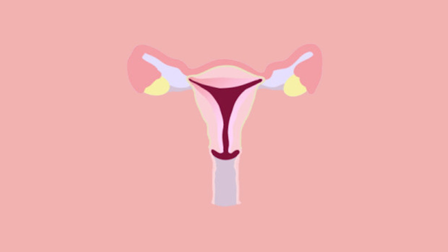 Things You Only Know If You Have Endometriosis