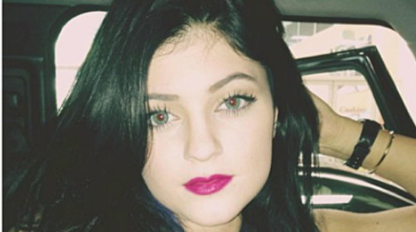 kylie-jenner-before-surgery3