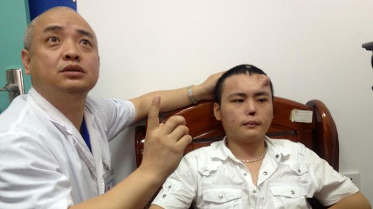 Doctor Guo Zhihui examines the extra nose on Xiao Lian's forehead