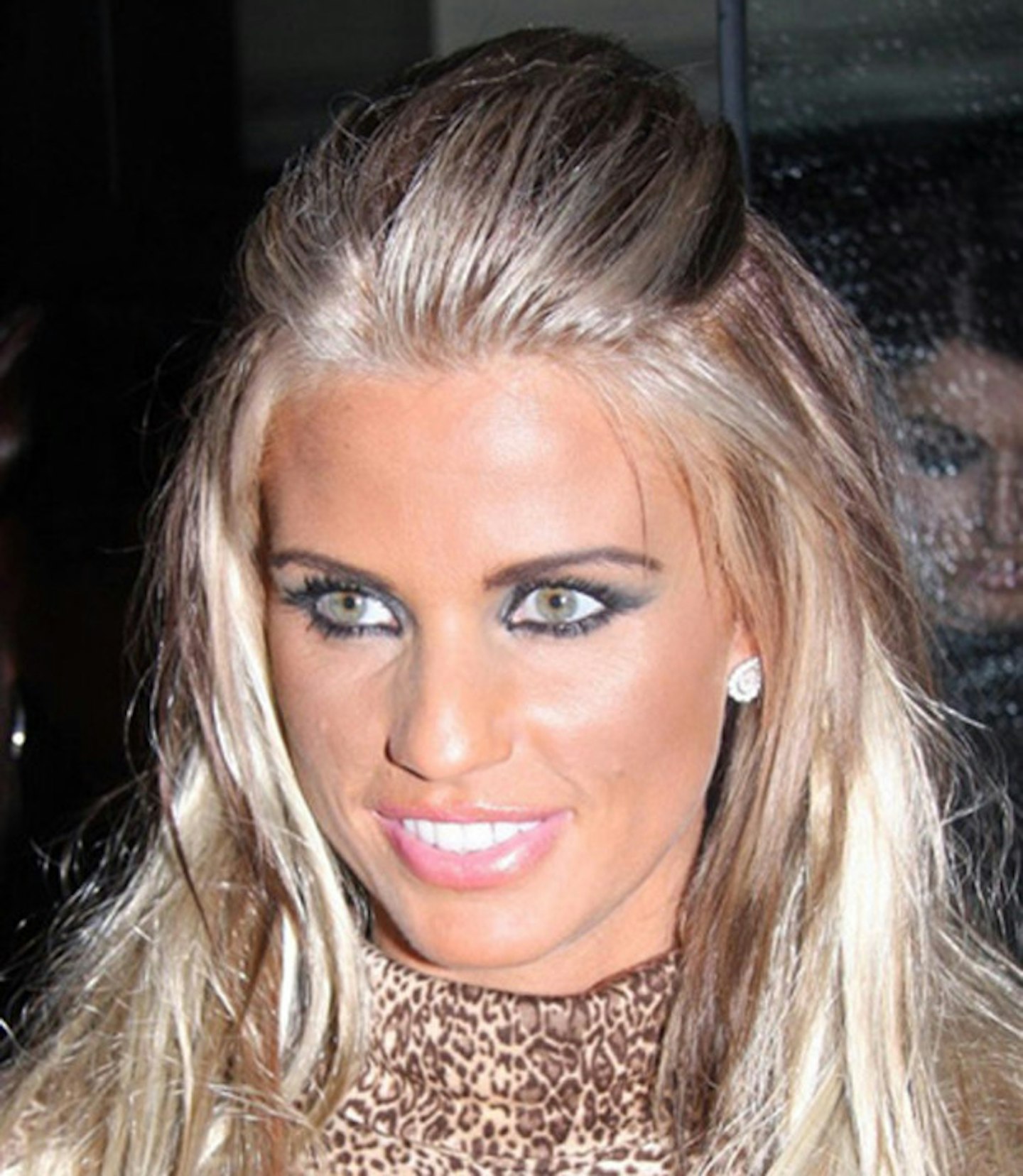 katie-price-jordan-cosmetic-plastic-surgery-before-and-after-36
