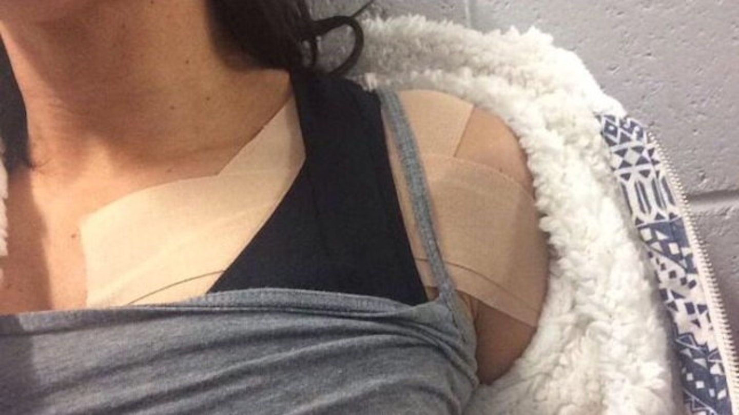 Hayley Tamaddon injured her shoulder badly during rehearsals