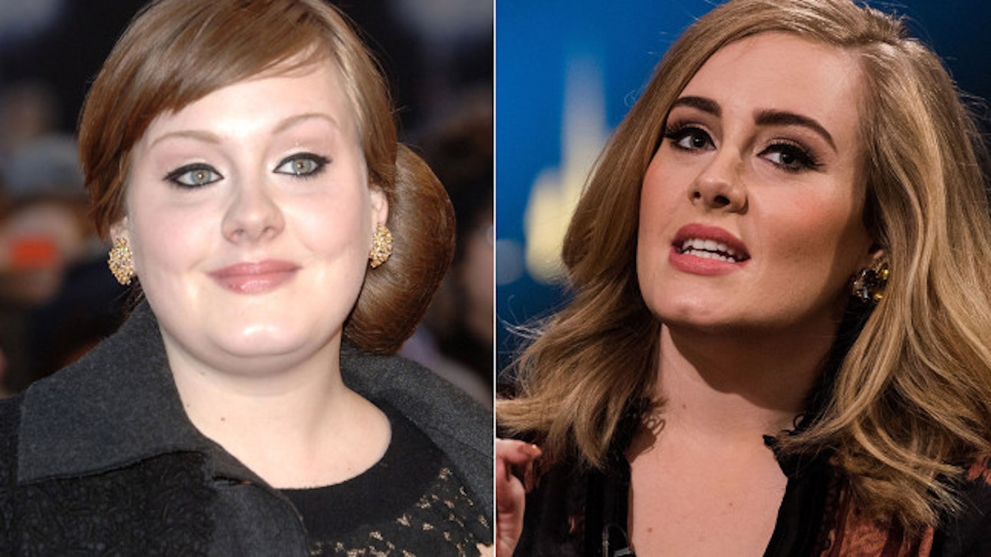 Adele Weight Loss Transformation: Photos Then Vs Now
