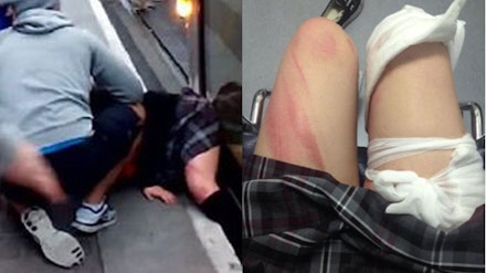 School Girl Dog Sex Videos - VIDEO: Schoolgirl rescued by commuters after she is dragged 50 yards by  city tram | Closer