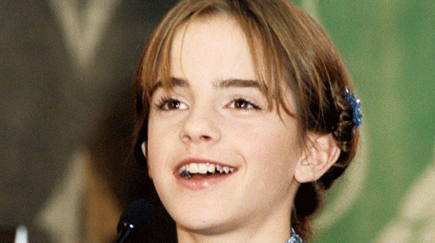 Emma-Watson-Harry-Potter-teeth