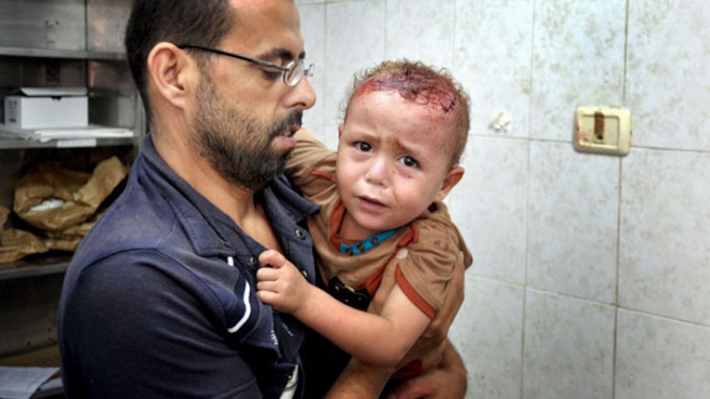 A young child is treated for injuries after an attack in Gaza.