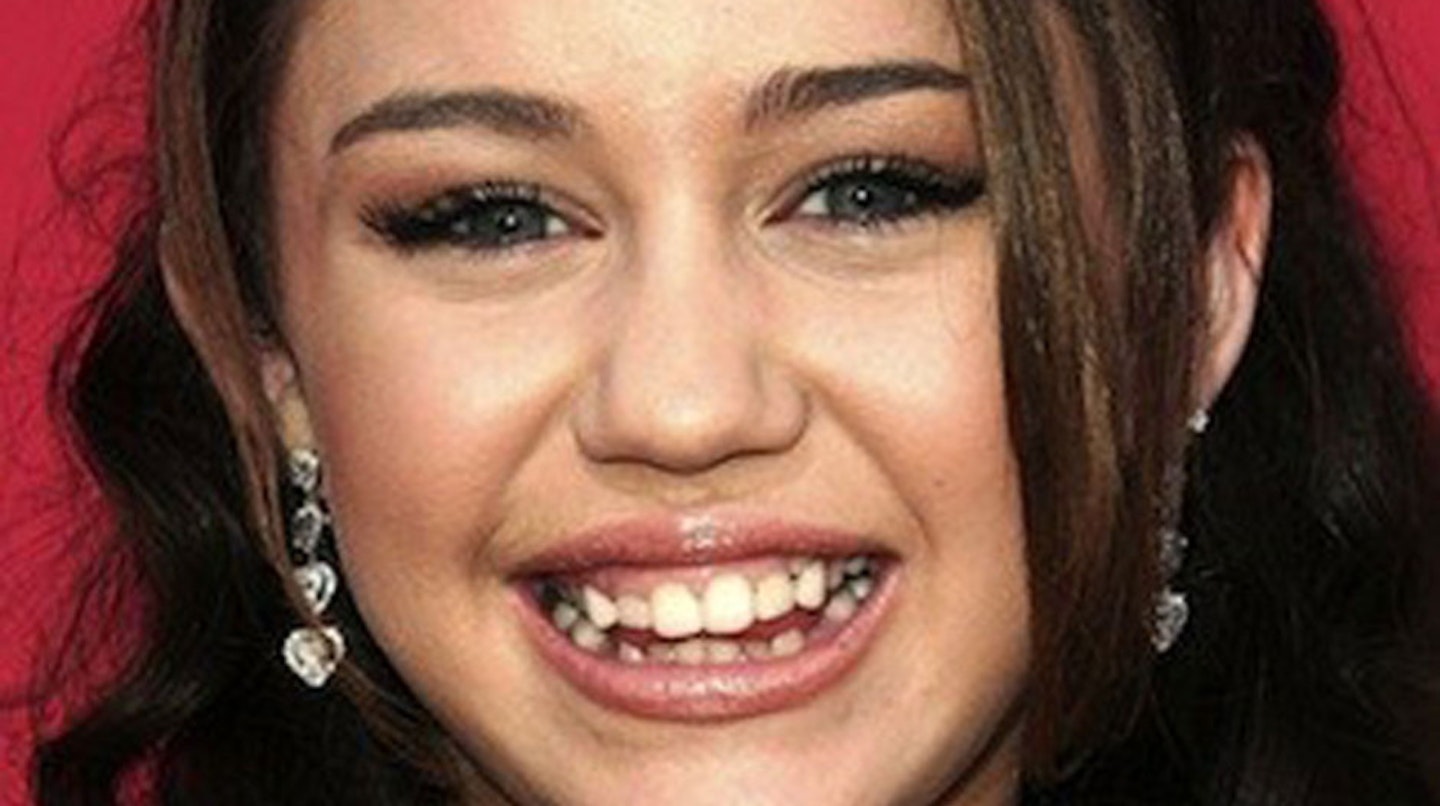 Miley-Cyrus-teeth-surgery-before