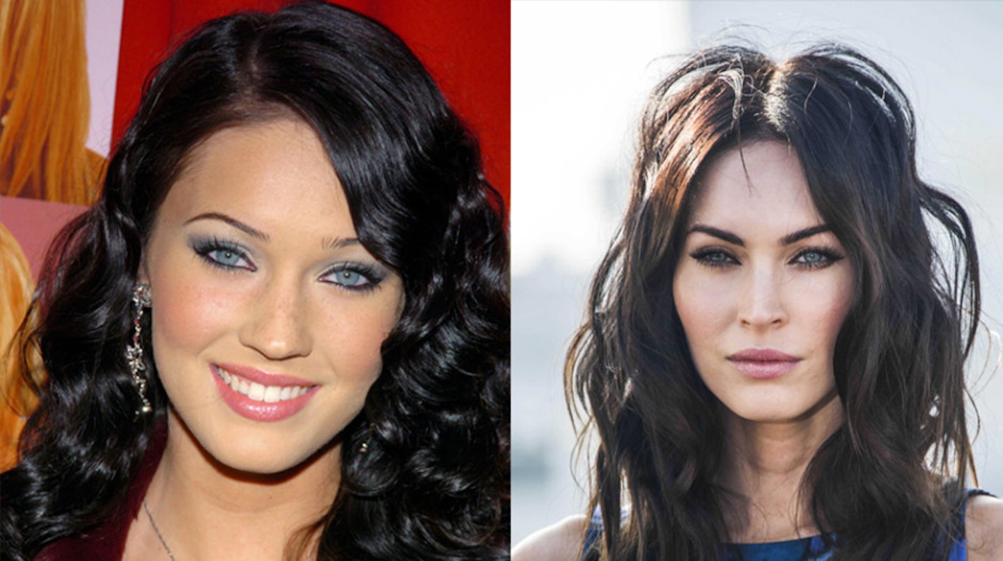 megan-fox-before-after-surgery