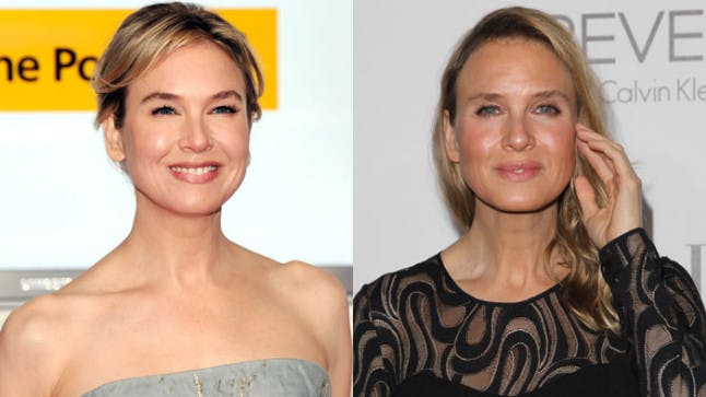 Renee Zellweger S Shocking Makeover What Has She Done To Her Face Closer