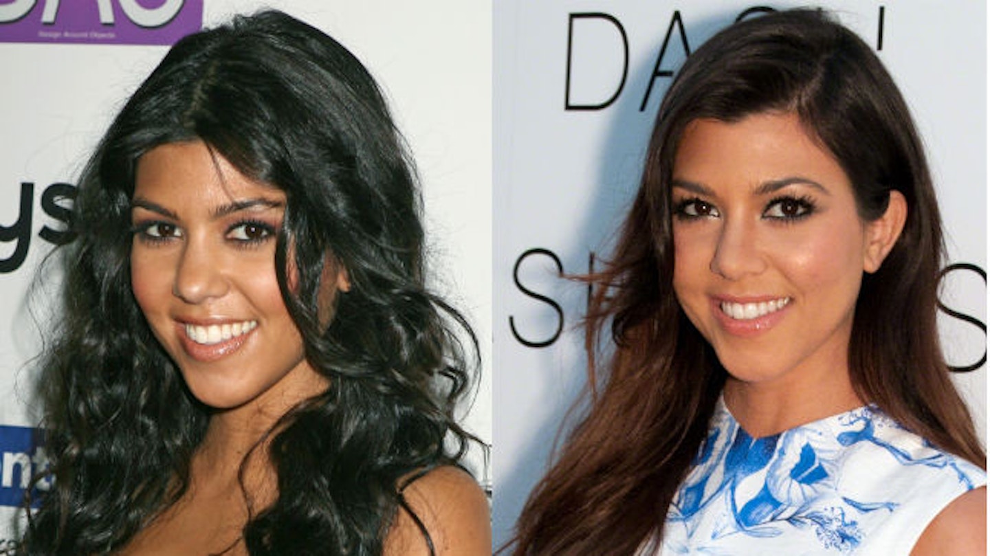 kourtney kardashian before and after surgery face